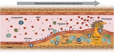 Mouse Models for Atherosclerosis Research—Which Is My Line?